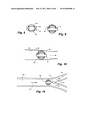 APPARATUS AND METHOD FOR SENSOR DEPLOYMENT AND FIXATION diagram and image