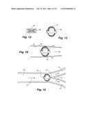 APPARATUS AND METHOD FOR SENSOR DEPLOYMENT AND FIXATION diagram and image