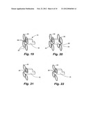 APPARATUS AND METHOD FOR SENSOR DEPLOYMENT AND FIXATION diagram and image