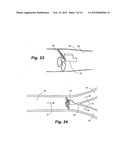 APPARATUS AND METHOD FOR SENSOR DEPLOYMENT AND FIXATION diagram and image