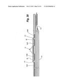 APPARATUS AND METHOD FOR SENSOR DEPLOYMENT AND FIXATION diagram and image