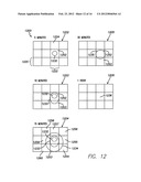 METHODS AND SYSTEMS TO MONITOR AND IDENTIFY TRANSIENT ISCHEMIA diagram and image