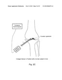 Methods and devices for real time monitoring of collagen content and for     altering collagen status diagram and image