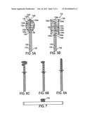 Aneurysm Flow Barrier diagram and image