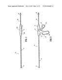 Wound Closure Material Applicator diagram and image