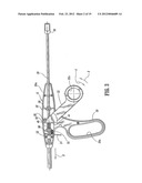 Wound Closure Material Applicator diagram and image