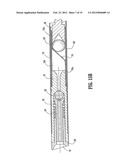 Wound Closure Material Applicator diagram and image