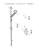 Wound Closure Material Applicator diagram and image