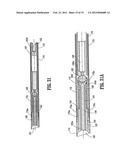 Wound Closure Material Applicator diagram and image