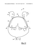 Method and Apparatus for Forming a Self-Locking Adjustable Loop diagram and image