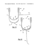 Method and Apparatus for Forming a Self-Locking Adjustable Loop diagram and image