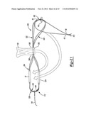 Method and Apparatus for Forming a Self-Locking Adjustable Loop diagram and image