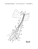 Method and Apparatus for Forming a Self-Locking Adjustable Loop diagram and image