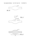 METHOD OF DELIVERING A MEDICAL DEVICE ACROSS A VALVE diagram and image