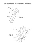 METHOD OF DELIVERING A MEDICAL DEVICE ACROSS A VALVE diagram and image