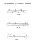 METHOD OF DELIVERING A MEDICAL DEVICE ACROSS A VALVE diagram and image