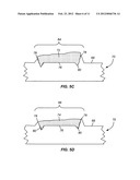 SURFACE TEXTURED IMPLANTS diagram and image