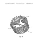 MEDICAL DEVICES AND DELIVERY SYSTEMS FOR DELIVERING MEDICAL DEVICES diagram and image