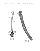 MEDICAL DEVICES AND DELIVERY SYSTEMS FOR DELIVERING MEDICAL DEVICES diagram and image