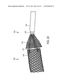 MEDICAL DEVICES AND DELIVERY SYSTEMS FOR DELIVERING MEDICAL DEVICES diagram and image