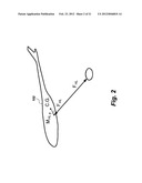 FUZZY LOGIC-BASED CONTROL METHOD FOR HELICOPTERS CARRYING SUSPENDED LOADS diagram and image