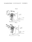 IMPLEMENT WITH LINKAGE ASSEMBLY AND WORK ASSEMBLY WHEREIN WORK ASSEMBLY     HAS DYNAMIC SKID SHOE AND A SCRAPING EDGE diagram and image