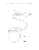 SYSTEMS AND METHODS FOR MAKING AND USING ENHANCED ELECTRODES FOR     ELECTRICAL STIMULATION SYSTEMS diagram and image