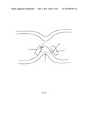 GASTROINTESTINAL DEVICE diagram and image