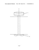 GASTROINTESTINAL DEVICE diagram and image