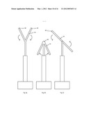 GASTROINTESTINAL DEVICE diagram and image