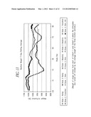 SPLANCHNIC NERVE STIMULATION FOR TREATMENT OF OBESITY diagram and image