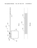  SHIELDED IMPLANTABLE MEDICAL LEAD WITH REDUCED TORSIONAL STIFFNESS diagram and image