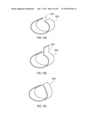  SHIELDED IMPLANTABLE MEDICAL LEAD WITH REDUCED TORSIONAL STIFFNESS diagram and image