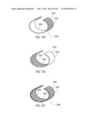  SHIELDED IMPLANTABLE MEDICAL LEAD WITH REDUCED TORSIONAL STIFFNESS diagram and image