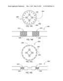  SHIELDED IMPLANTABLE MEDICAL LEAD WITH REDUCED TORSIONAL STIFFNESS diagram and image