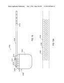  SHIELDED IMPLANTABLE MEDICAL LEAD WITH REDUCED TORSIONAL STIFFNESS diagram and image