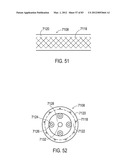  SHIELDED IMPLANTABLE MEDICAL LEAD WITH REDUCED TORSIONAL STIFFNESS diagram and image