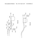  SHIELDED IMPLANTABLE MEDICAL LEAD WITH REDUCED TORSIONAL STIFFNESS diagram and image