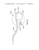  SHIELDED IMPLANTABLE MEDICAL LEAD WITH REDUCED TORSIONAL STIFFNESS diagram and image