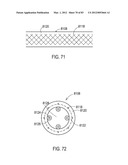  SHIELDED IMPLANTABLE MEDICAL LEAD WITH REDUCED TORSIONAL STIFFNESS diagram and image