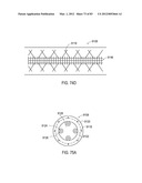  SHIELDED IMPLANTABLE MEDICAL LEAD WITH REDUCED TORSIONAL STIFFNESS diagram and image