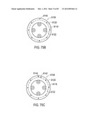  SHIELDED IMPLANTABLE MEDICAL LEAD WITH REDUCED TORSIONAL STIFFNESS diagram and image