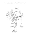 FIXATION COMPONENTS FOR IMPLANTABLE MEDICAL DEVICES AND ASSOCIATED DEVICE     CONSTRUCTION diagram and image