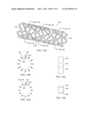 BIOERODIBLE ENDOPROSTHESES AND METHODS OF MAKING THE SAME diagram and image