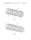 BIOERODIBLE ENDOPROSTHESES AND METHODS OF MAKING THE SAME diagram and image