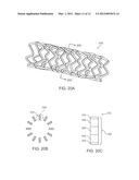 BIOERODIBLE ENDOPROSTHESES AND METHODS OF MAKING THE SAME diagram and image