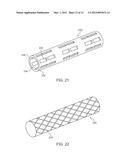 BIOERODIBLE ENDOPROSTHESES AND METHODS OF MAKING THE SAME diagram and image