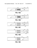 Implantable Prosthetic Vascular Valves diagram and image