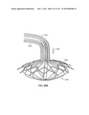 Reconfiguring Heart Features diagram and image