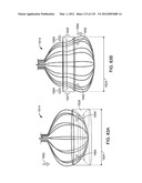 Reconfiguring Heart Features diagram and image